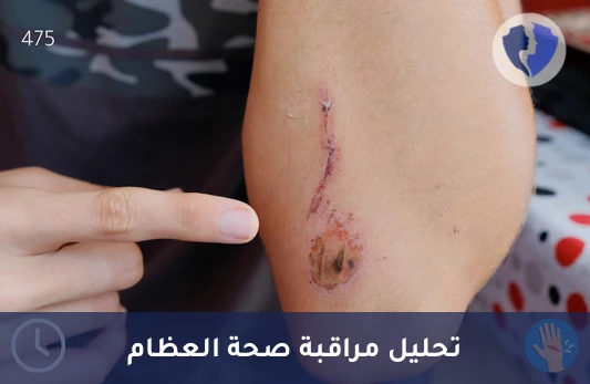 فحص صحة الأنسجة والكولاجين - تحليل الهيدروكسي برولين (Hydroxyproline) بتقنية (LC-MS/MS)