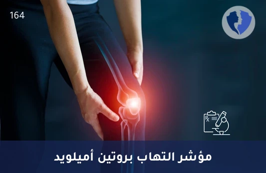 فحص مؤشرات الالتهاب المزمن - تحليل بروتين أميلويد أ (Amyloid A)