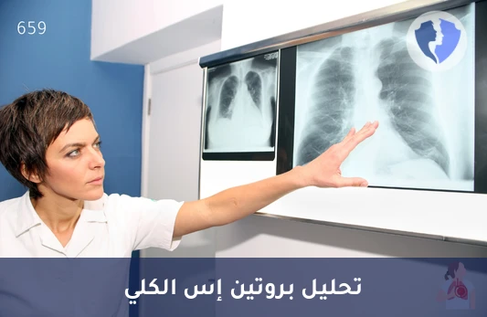 فحص البروتين S الكلي - تحليل بروتين إس الكلي (Protein S - Total)