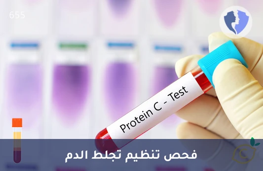 فحص توازن تجلط الدم - تحليل بروتين سي (Protein C)