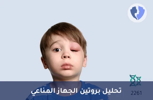 فحص بروتين مثبط C1 - تحليل بروتين مثبط C1 إستريز (C1 Esterase Inhibitor)