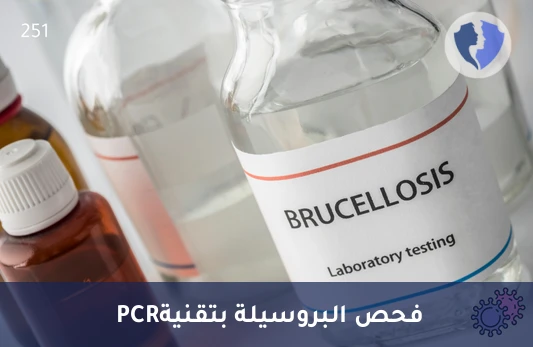 فحص البروسيلات (PCR) - تحليل بكتيريا البروسيلة بتقنية (PCR)