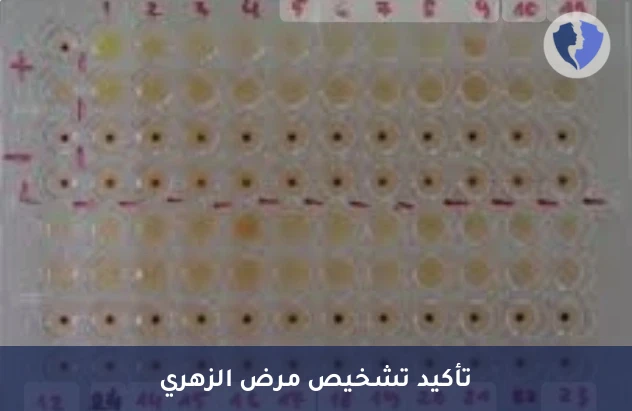 فحص تأكيد تشخيص الزهري - تحليل تأكيد الزهري (TPHA)