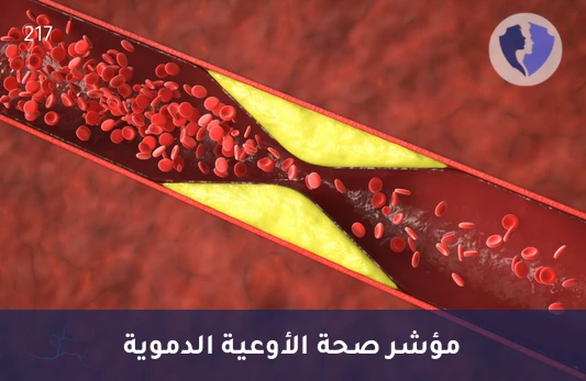 اطمئن على صحة أوعيتك الدموية - تحليل ثنائي ميثيل أرجينين غير المتماثل (ADMA)