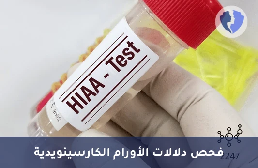 الكشف عن أورام الجهاز الهضمي - تحليل حمض 5-هيدروكسي إندول أسيتيك في البول (5-HIAA)