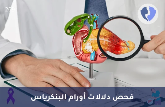 فحص دلالات أورام البنكرياس - تحليل دلالات أورام البنكرياس (CA 19-9)