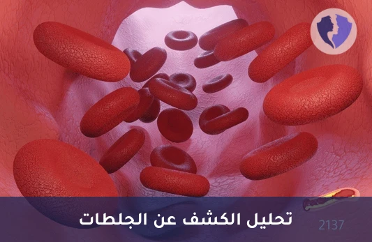 فحص دي-دايمر للجلطات - تحليل دي دايمر (D-Dimer)