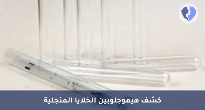 فحص الأنيميا المنجلية - تحليل ذوبان الخلايا المنجلية (Sickle Cell Test)