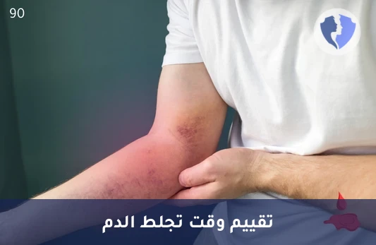 فحص زمن البروثرومبين للتجلط - تحليل زمن البروثرومبين (PT)