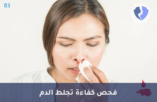 فحص كفاءة تجلط الدم - تحليل زمن الثرومبوبلاستين الجزئي (PTT)