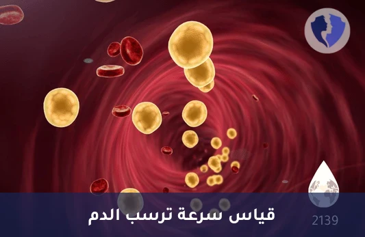 فحص سرعة الترسيب - تحليل سرعة ترسب الدم (ESR)