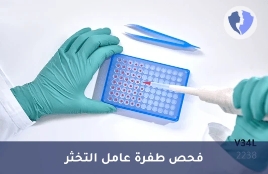 فحص طفرة عامل التجلط 13 - تحليل طفرة عامل التخثر الثالث عشر (Factor XIII V34L) بتقنية (PCR)