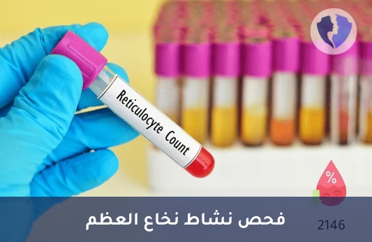 فحص الخلايا الشبكية - تحليل عد الخلايا الشبكية (Reticulocyte Count)