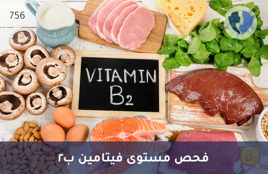 فحص مستوى فيتامين ب2 - تحليل فيتامين ب2 (Vitamin B2)