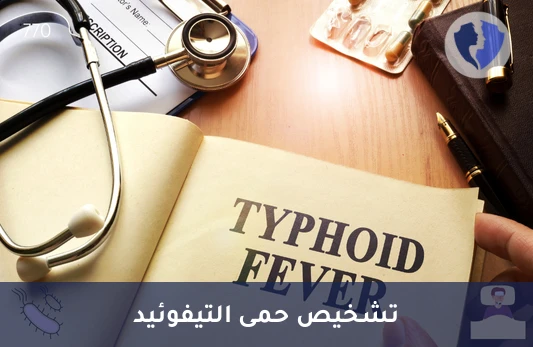 فحص التيفوئيد السريع (ويدال) - تحليل فيدال لتشخيص التيفوئيد (Widal Test)