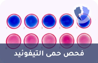 فحص حمى التيفوئيد - تحليل فيدال للكشف عن حمى التيفوئيد (Widal Test)