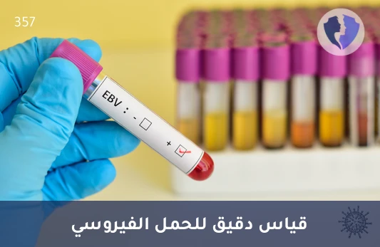 فحص نشاط فيروس إبشتاين-بار - تحليل فيروس إبشتاين-بار الكمي بتقنية (PCR)