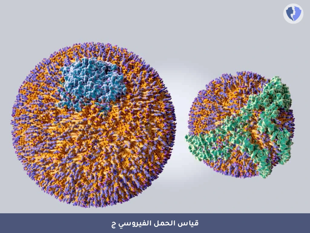 قياس الحمل الفيروسي للكبد (ج) - تحليل فيروس التهاب الكبد ج الكمي (HCV RNA PCR)