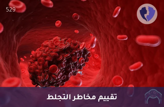 تحليل مانع تخثر الذئبة - تحليل مانع تجلط الذئبة (Lupus Anticoagulant)