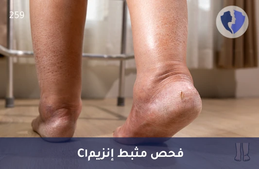 افحص توازن جهازك المناعي - تحليل مثبط إنزيم سي 1 إستريز (C1 Esterase Inhibitor)