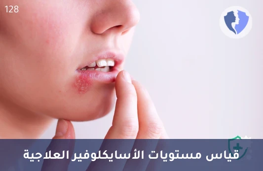 متابعة علاج الأسيكلوفير - تحليل مستوى الأسايكلوفير (Acyclovir)