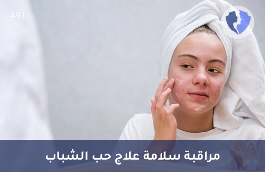متابعة علاج حب الشباب - تحليل مستوى الأيزوتريتينوين (Isotretinoin)