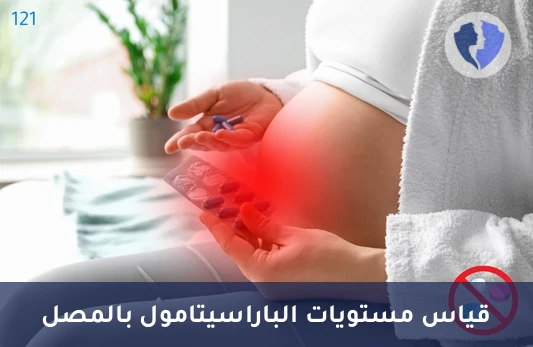 فحص مستوى الباراسيتامول بالدم - تحليل مستوى الباراسيتامول (Acetaminophen)