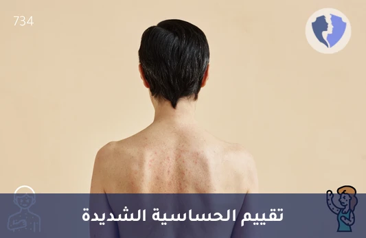 تشخيص الحساسية المفرطة بدقة - تحليل مستوى التريبتيز (Tryptase)