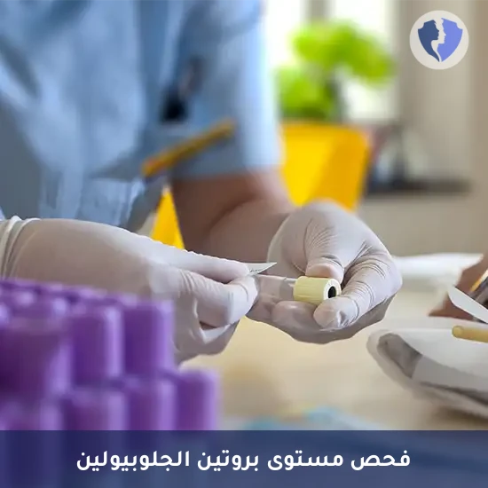فحص مستوى الجلوبيولين بالدم - تحليل مستوى الجلوبيولين في الدم (Globulin)