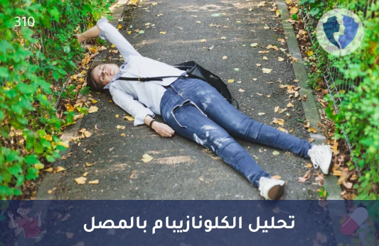 فحص مستوى الكلونازيبام بالدم - تحليل مستوى الكلونازيبام في المصل (HPLC)