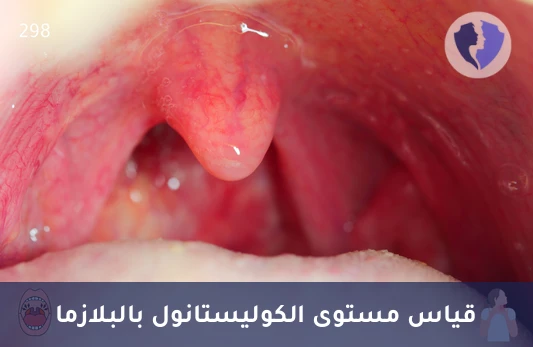 تحليل مستوى الكوليستانول