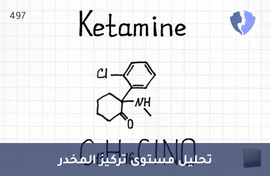 فحص مستوى الكيتامين في الدم - تحليل مستوى الكيتامين (Ketamine)