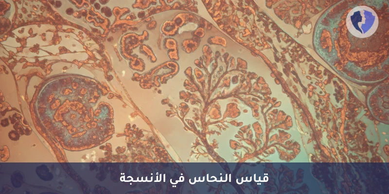 فحص النحاس في الأنسجة - تحليل مستوى النحاس في الأنسجة (Copper)