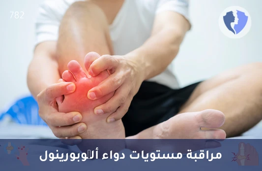 متابعة علاج النقرس والأملاح - تحليل مستوى دواء ألُّوبورينول في الدم (Allopurinol)