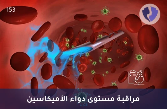 مراقبة مستوى مضاد أميكاسين - تحليل مستوى دواء الأميكاسين (Amikacin Level)