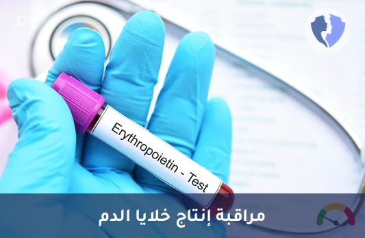 فحص هرمون الإريثروبويتين (EPO) - تحليل مستوى هرمون الإريثروبويتين (Erythropoietin)
