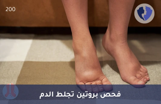 فحص توازن تجلط الدم - تحليل مضاد الثرومبين الثالث (Anti Thrombin III)