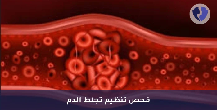 فحص مخاطر الجلطات الوريدية - تحليل منشط البلازمينوجين النسيجي (t-PA)