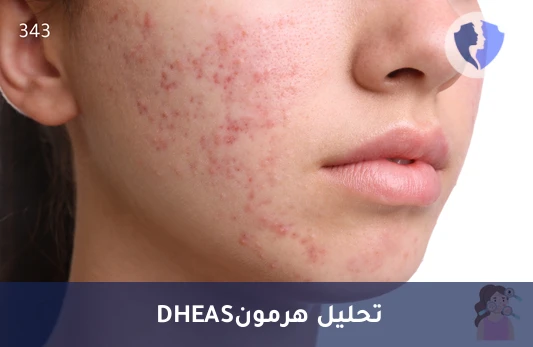 فحص توازن هرمونات الكظرية - تحليل هرمون ديهيدرو إيبي آندروستيرون سلفات (DHEAS)