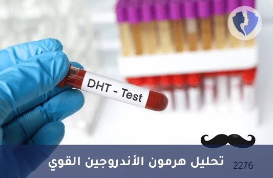 فحص هرمون الذكورة النشط - تحليل هرمون ديهيدروتستوستيرون (DHT)