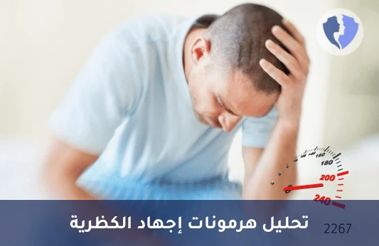 فحص هرمونات التوتر والنشاط - تحليل هرمونات الكاتيكولامينات في البلازما (Catecholamines)