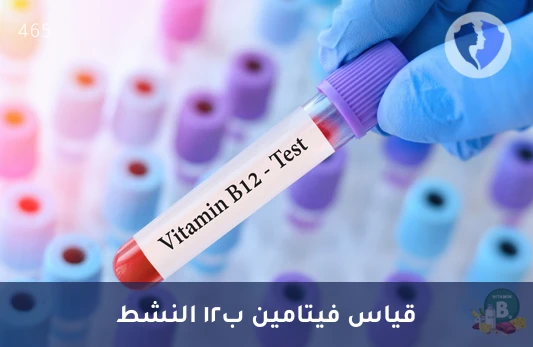 فحص فيتامين B12 النشط - تحليل هولوتراسكوبالامين - فيتامين ب12 النشط (Holotranscobalamin)