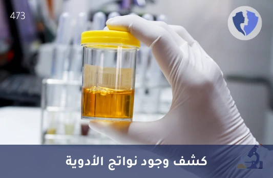 فحص مستوى مهدئ فورازيبام - تحليل هيدروكسي إيثيل فورازيبام (Hydroxyethylfurazepam) في البول