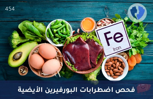 تحليل البورفيرينات في البول - تحليل هيكساكاربوكسيل بورفيرين في البول (Hexacarboxylporphyrins)