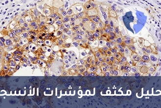 تحليل العلامات الحيوية الثنائي - تحليل واستشارة الكيمياء النسيجية المناعية (2 Markers) (IHC)