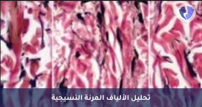 صبغة الألياف المرنة للأنسجة - صبغة الألياف المرنة النسيجية (Elastic Stain)