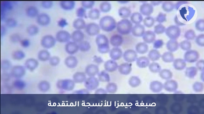 صبغة جيمزا للميكروبات - صبغة جيمزا النسيجية (Giemsa Stain)