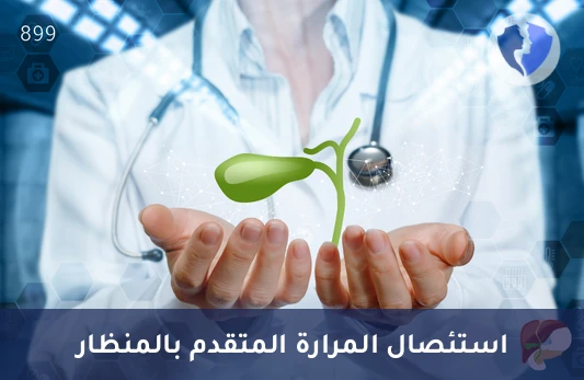 استئصال المرارة بالمنظار