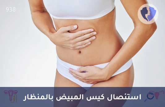 استئصال كيس مبيض بالمنظار - عملية استئصال كيس المبيض بالمنظار (جهة واحدة)