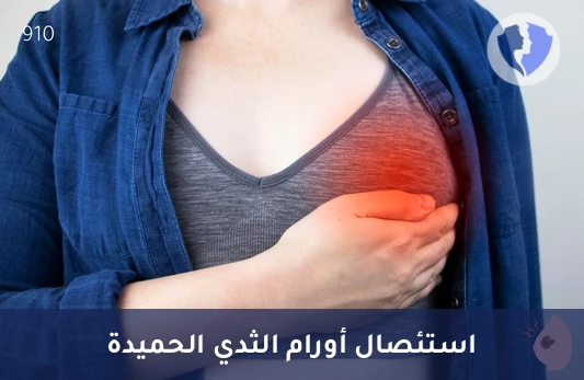 استئصال ورم الثدي الحميد - عملية استئصال ورم حميد في الثدي تحت التخدير العام